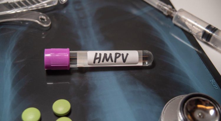 Nuevo caso de Metapneumovirus Humano, ahora en Chihuahua